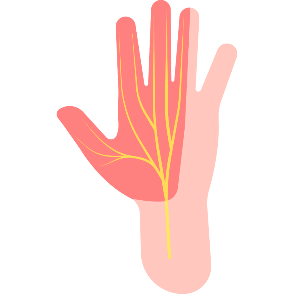 正中神経　手首の痛み　指の痛み　手根管症候群